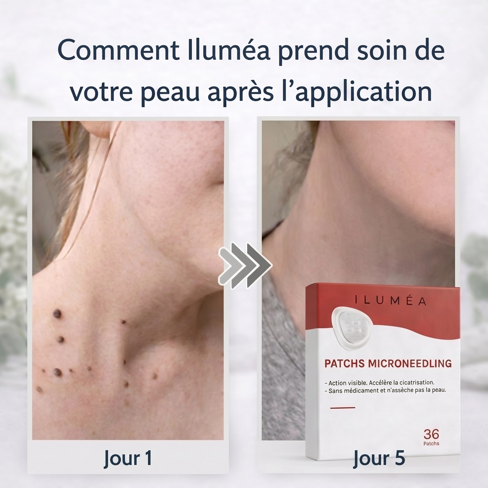 Patchs pour la peau