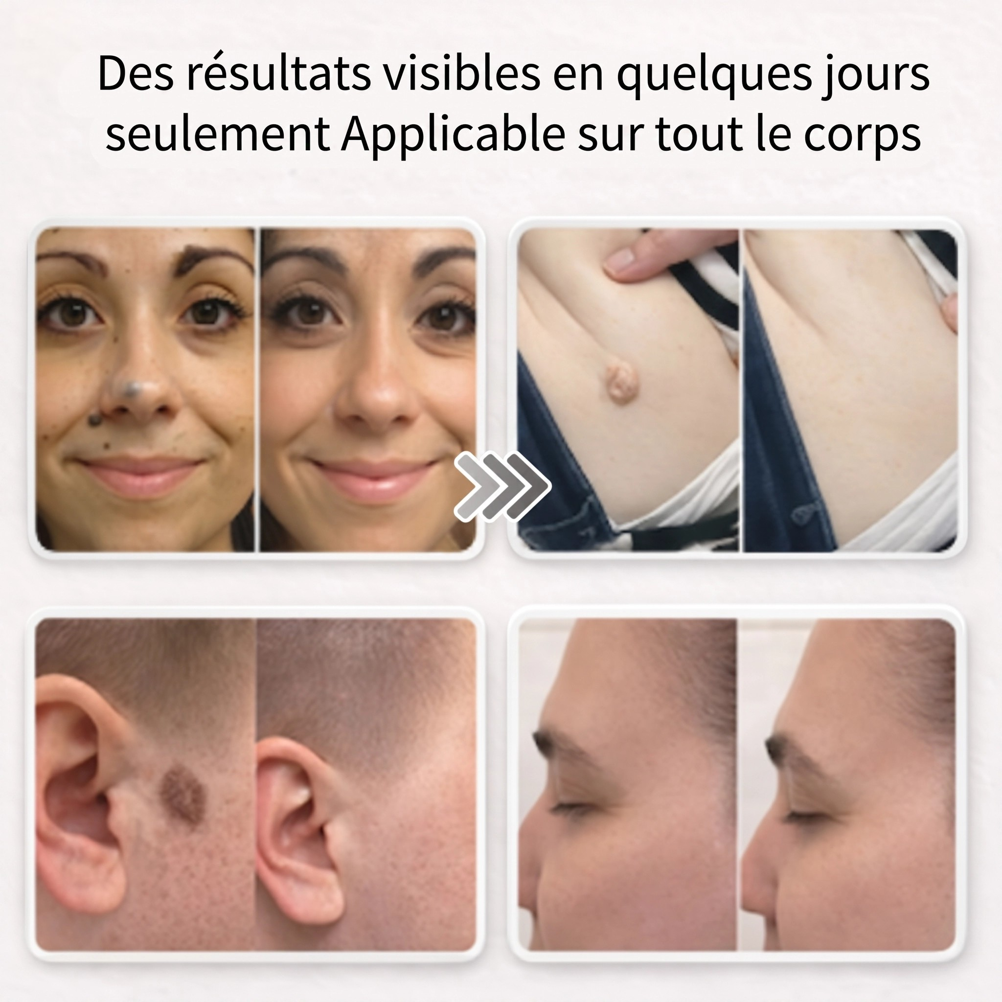 Patchs pour la peau
